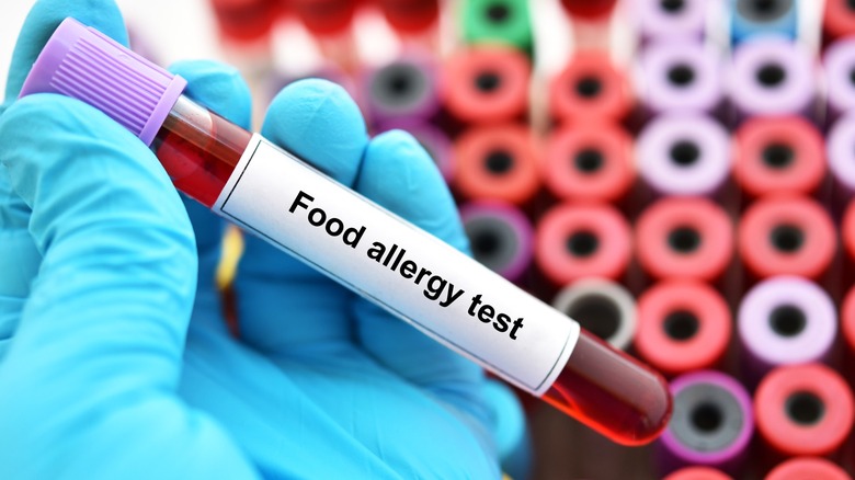 Gloved hand holding tube reading "Food Allergy Test"