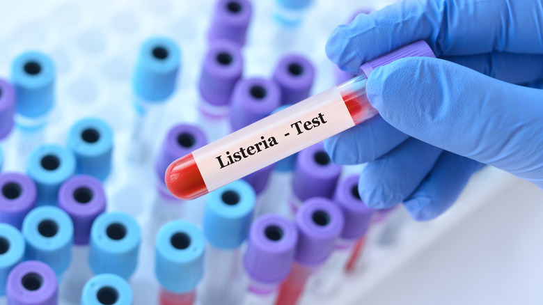 Doctor holding a test blood sample tube with Listeria bacteria test on the background of medical test tubes with analyzes.