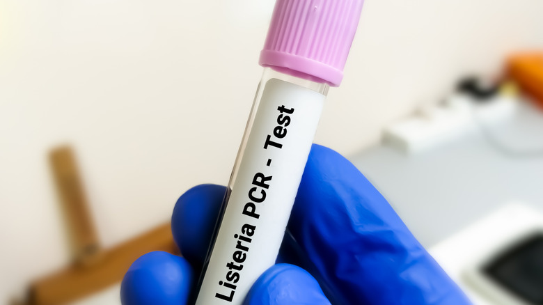A gloved hand holds a Listeria test tube